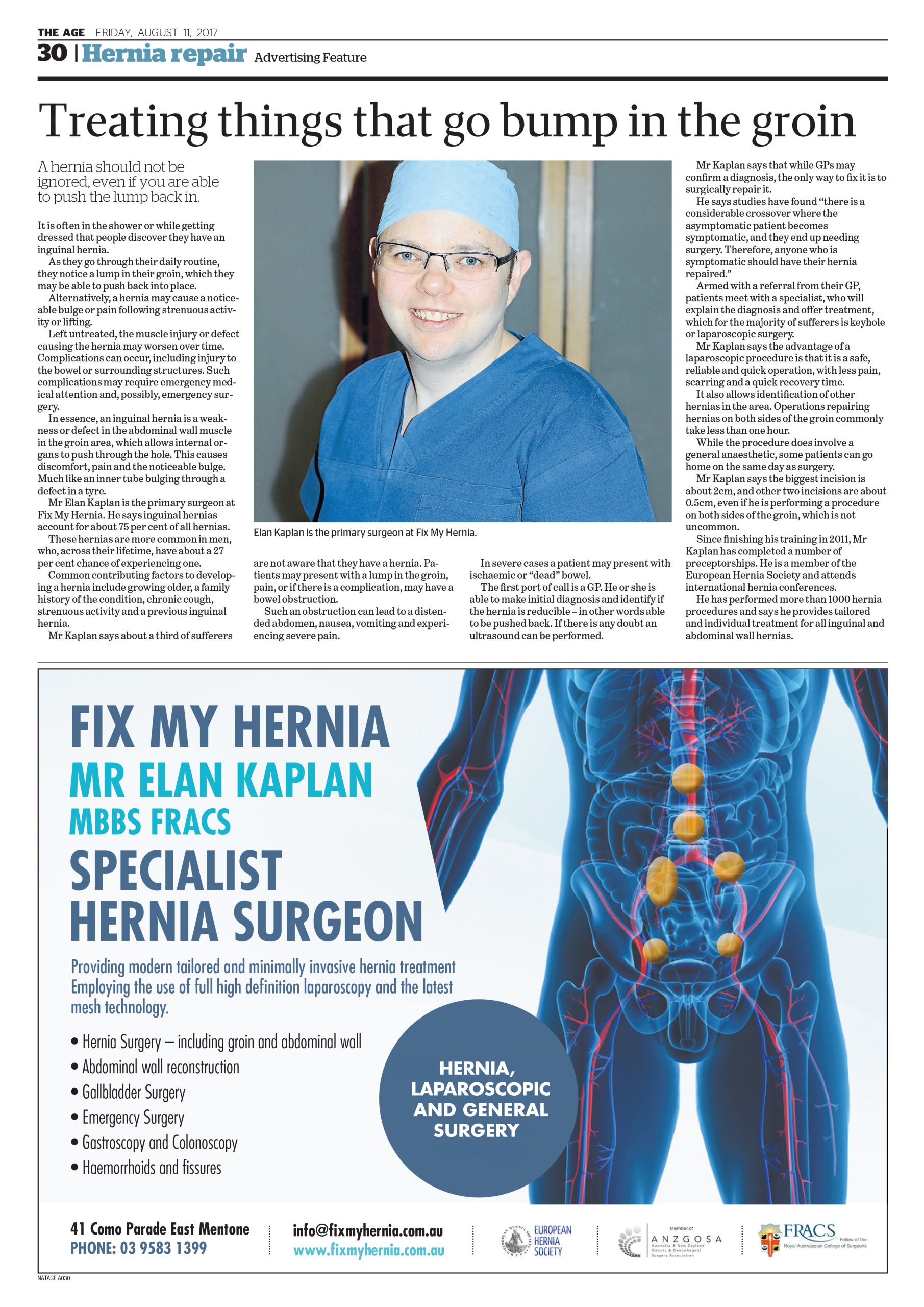 Hernia repair the age Elan Kaplan